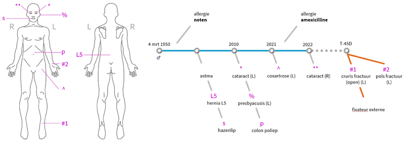 Bestand:Tijdlijn-bgz-msz-v2-patA-tijdlijn-v2.png