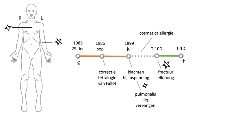 Bestand:Tijdlijn-bgz-msz-patD-v1.png